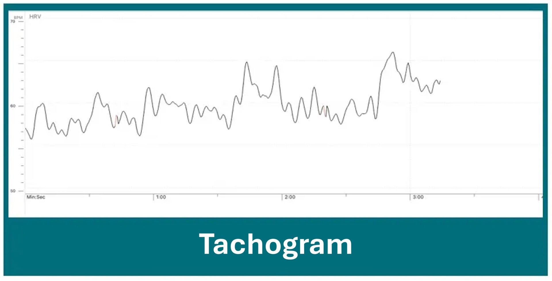 emWave tachogram screen
